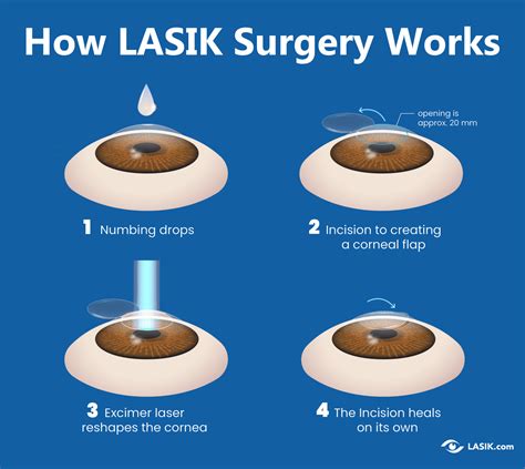 Top 10 Best Laser Eye Surgery/Lasik in Huddersfield, West  .